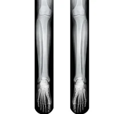 Podkolanówki SZKIELETOR z nadrukiem 3D