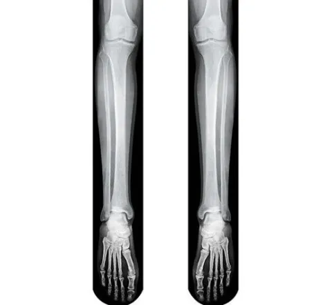 Podkolanówki SZKIELETOR z nadrukiem 3D